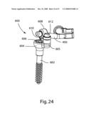 SYSTEM AND METHOD FOR FACET JOINT REPLACEMENT diagram and image