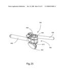 SYSTEM AND METHOD FOR FACET JOINT REPLACEMENT diagram and image