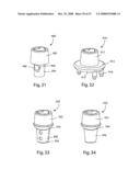 SYSTEM AND METHOD FOR FACET JOINT REPLACEMENT diagram and image