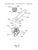 SYSTEM AND METHOD FOR FACET JOINT REPLACEMENT diagram and image