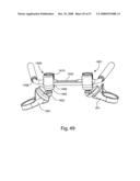 SYSTEM AND METHOD FOR FACET JOINT REPLACEMENT diagram and image