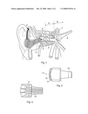 Use of Electromagnetic Radiation in the Treatment of Sensory Organs diagram and image