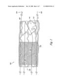 Percutaneous valve, system and method diagram and image