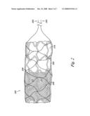 Percutaneous valve, system and method diagram and image