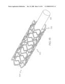 FLEXIBLE AND EXPANDABLE STENT diagram and image