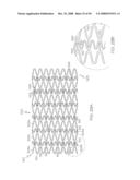 FLEXIBLE AND EXPANDABLE STENT diagram and image