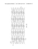 FLEXIBLE AND EXPANDABLE STENT diagram and image