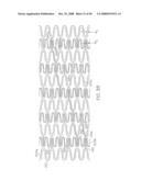 FLEXIBLE AND EXPANDABLE STENT diagram and image