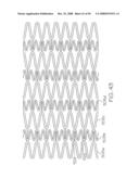 FLEXIBLE AND EXPANDABLE STENT diagram and image