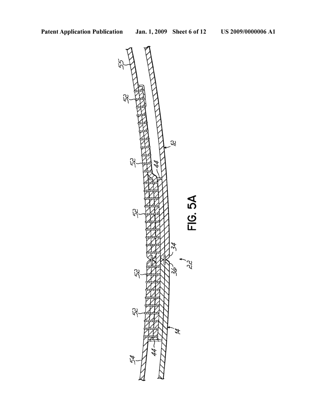 ARTICLE OF CLOTHING WITH SIDE ACCESS - diagram, schematic, and image 07