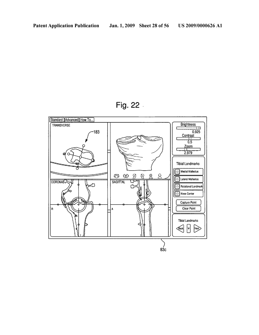 HAPTIC GUIDANCE SYSTEM AND METHOD - diagram, schematic, and image 29