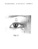 Eye Form Classifying Method, Form Classification Map, And Eye Cosmetic Treatment Method diagram and image