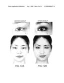 Eye Form Classifying Method, Form Classification Map, And Eye Cosmetic Treatment Method diagram and image