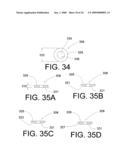 Shock absorber apparatus diagram and image