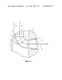 APPARATUS AND METHOD FOR REPAIRING RISER PIPE ELBOW WELD IN BOILING WATER NUCLEAR REACTOR diagram and image