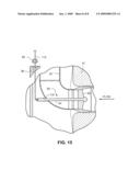 APPARATUS AND METHOD FOR REPAIRING RISER PIPE ELBOW WELD IN BOILING WATER NUCLEAR REACTOR diagram and image