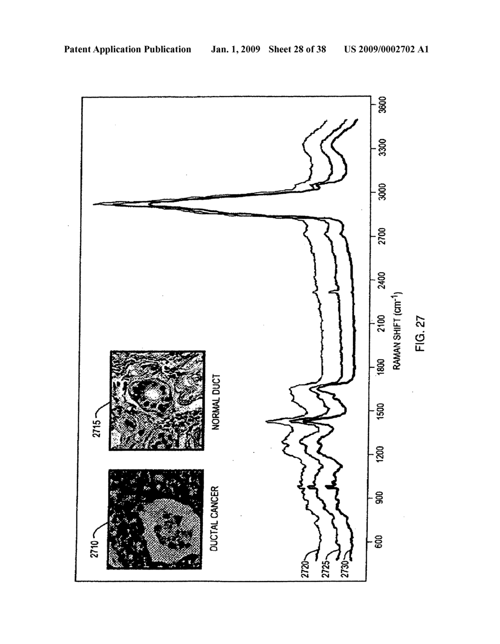 DISTINGUISHING BETWEEN RENAL ONCOCYTOMA AND CHROMOPHOBE RENAL CELL CARCINOMA USING RAMAN MOLECULAR IMAGING - diagram, schematic, and image 29