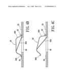 Circuit protection element and a circuit board with the circuit protection element diagram and image