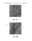 Nondestructive Residential Inspection Method and Apparatus diagram and image