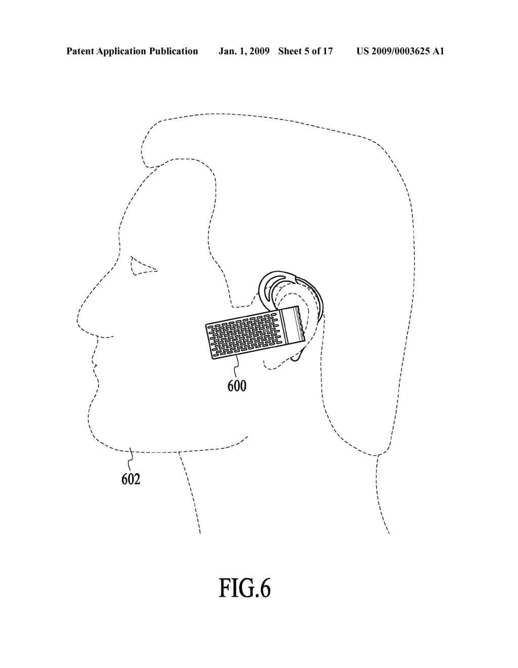 Dual Omnidirectional Microphone Array (DOMA) - diagram, schematic, and image 06