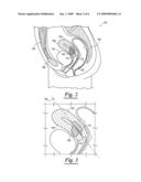 System and methods for image analysis and treatment diagram and image