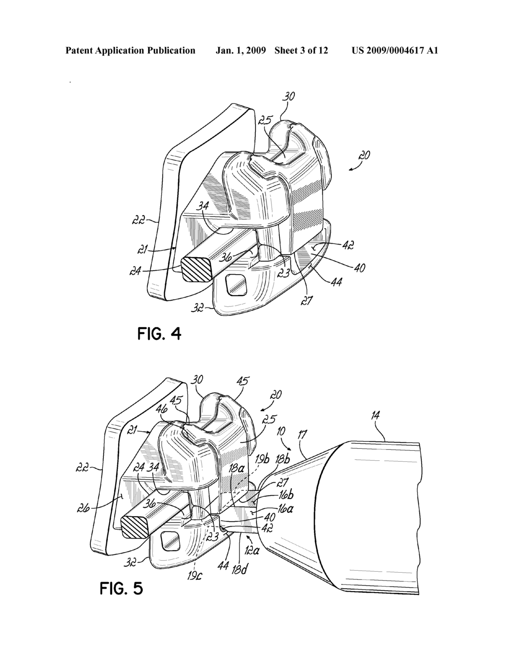 SELF-LIGATING ORTHODONTIC BRACKETS AND ORTHODONTIC BRACKET SYSTEMS - diagram, schematic, and image 04