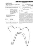 Strengthened ceramic restoration diagram and image