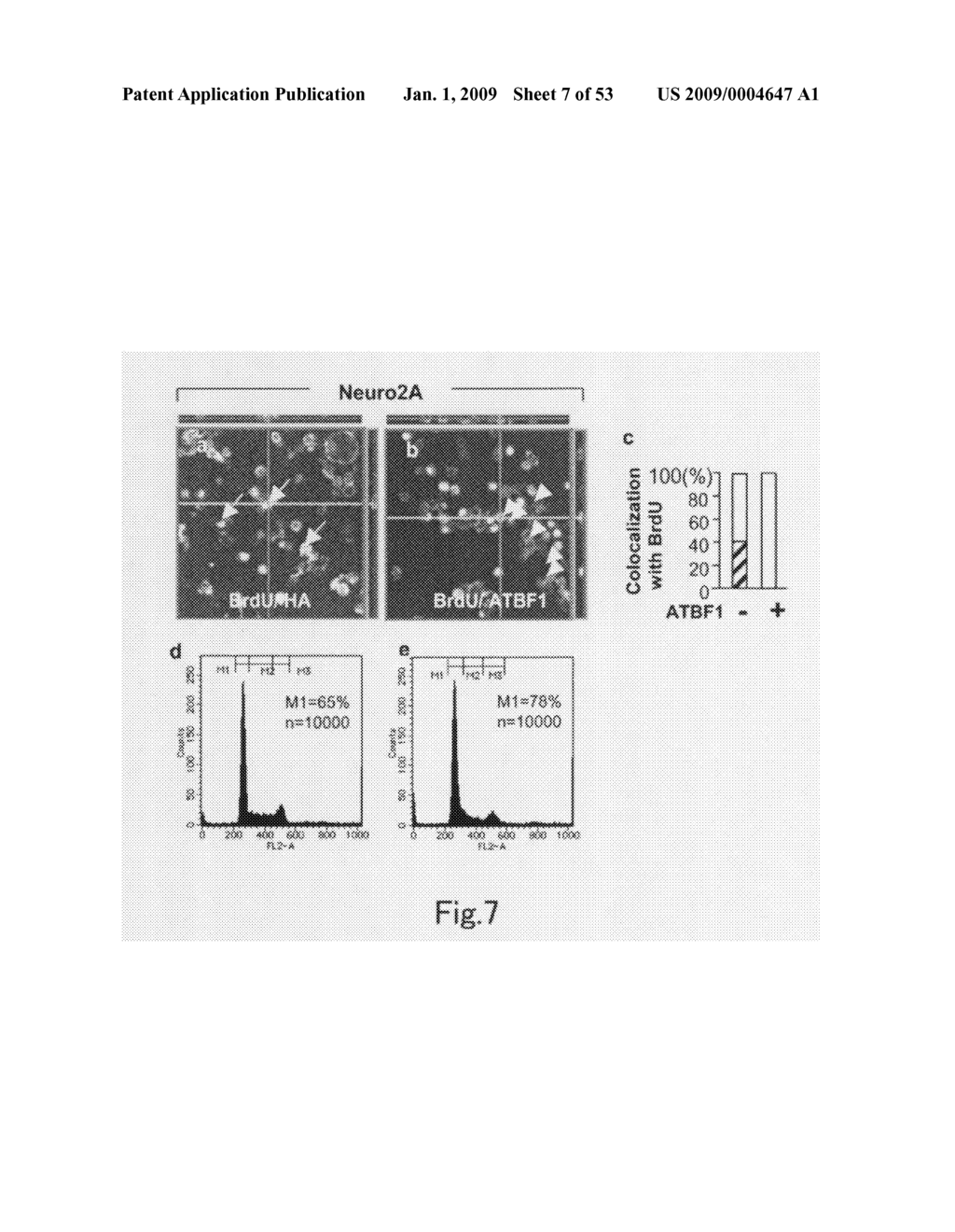 Method of Judging Grade of Malignancy of Carcinoma Cell - diagram, schematic, and image 08