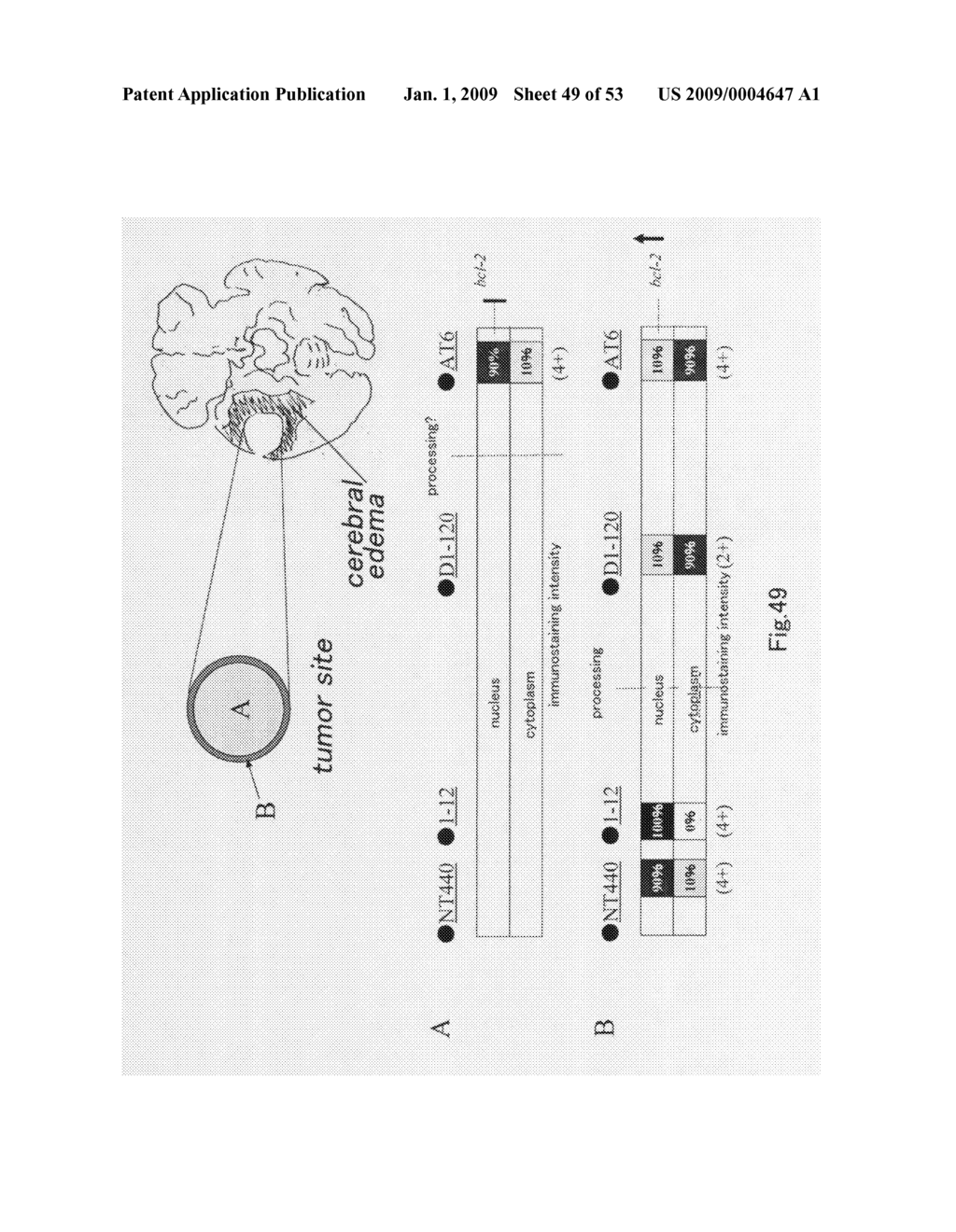 Method of Judging Grade of Malignancy of Carcinoma Cell - diagram, schematic, and image 50