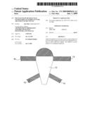 Multi-Leveled Transgluteal Tension-Free Levatorplasty For Treatment of Rectocele diagram and image