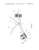Device for Laparoscopic or Thoracoscopic Surgery diagram and image