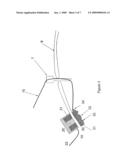 Device for Laparoscopic or Thoracoscopic Surgery diagram and image