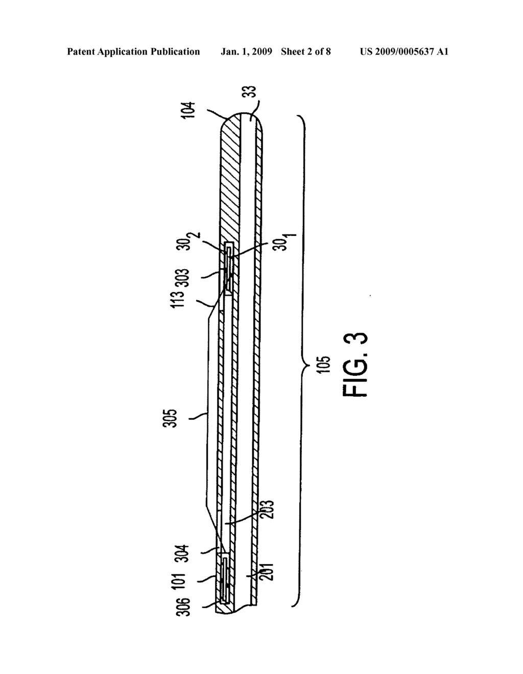 Method and Apparatus for Measuring and Controlling Blade Depth of a Tissue Cutting Apparatus in an Endoscopic Catheter - diagram, schematic, and image 03