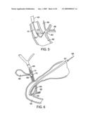 Method and Apparatus for Measuring and Controlling Blade Depth of a Tissue Cutting Apparatus in an Endoscopic Catheter diagram and image