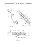 Rotate-to- advance catheterization system diagram and image