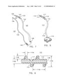 Rotate-to- advance catheterization system diagram and image