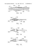 Rotate-to- advance catheterization system diagram and image