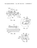 Rotate-to- advance catheterization system diagram and image