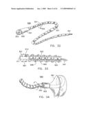 Rotate-to- advance catheterization system diagram and image