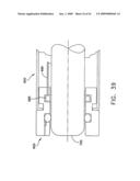 Rotate-to- advance catheterization system diagram and image