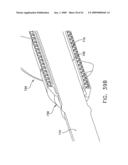 Rotate-to- advance catheterization system diagram and image