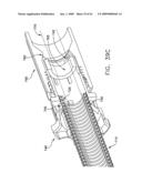 Rotate-to- advance catheterization system diagram and image