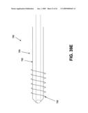 Rotate-to- advance catheterization system diagram and image