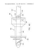 Rotate-to- advance catheterization system diagram and image