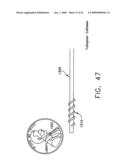 Rotate-to- advance catheterization system diagram and image