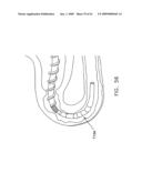 Rotate-to- advance catheterization system diagram and image