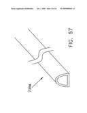 Rotate-to- advance catheterization system diagram and image