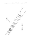 Rotate-to- advance catheterization system diagram and image