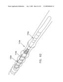 Rotate-to- advance catheterization system diagram and image