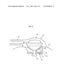 Cradled Sensor Assembly diagram and image